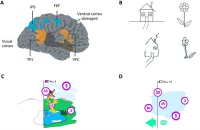 Advancements in brain-computer interfaces for the rehabilitation of unilateral spatial neglect: a concise review